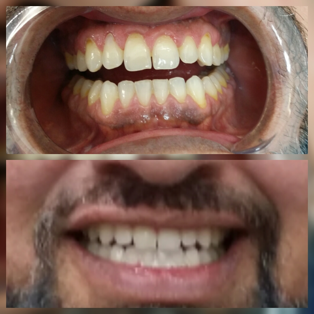before and after images